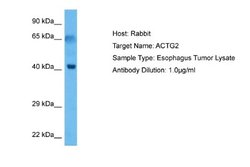 actin, gamma 2 Rabbit anti-Human, Polyclonal, Novus Biologicals 0.1ml;